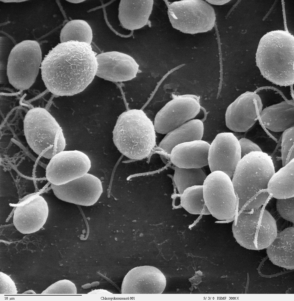 Imagem de microscópio eletrônico em preto e branco mostrando dezenas de células ovais de alga, cada uma com dois filamentos finos, sobre fundo escuro